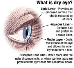 dryeye diagram